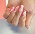 Gel et VSP